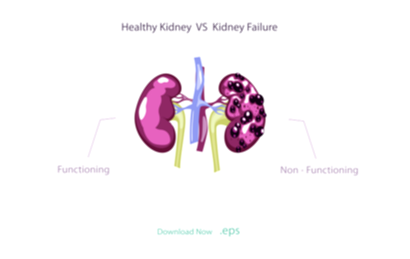 Human kidney chronic disease vector illustration