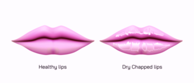 Healthy Lips vs Chapped Lips Comparison and Care Vector Illustration