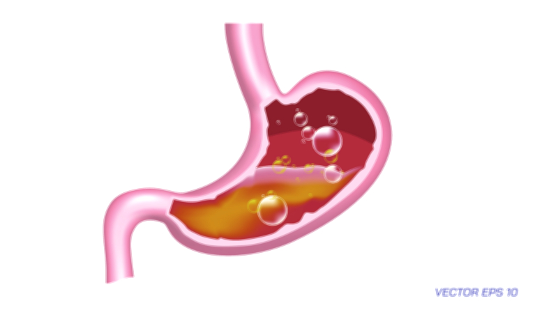 Common Stomach Symptoms medical education vector illustration for health awareness and digestive system learning