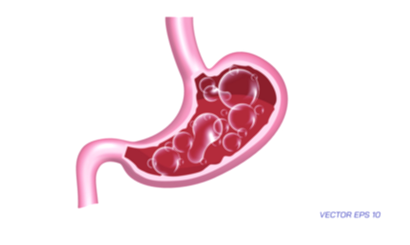 Stomach Issues and Problems medical education vector illustration for digestive health awareness and anatomy learning