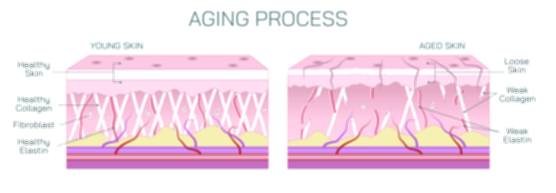 Skin Aging Process Vector Illustration Showing Wrinkle Formation, Elasticity Loss, and Cellular Changes in Human Skin