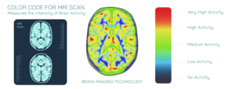 MRI Scan and Color Code Vector Illustration Showing Brain Imaging, Medical Diagnosis, and Anatomical Mapping Visualization