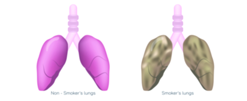 Healthy Lungs vs Smoking Lungs Vector Illustration Showing Normal Lung Tissue, Damaged Lungs, and Respiratory Health Comparison