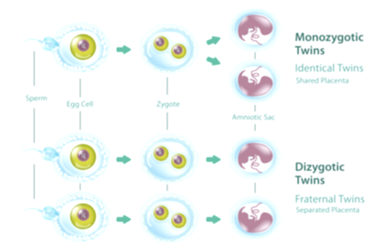 Monozygotic and Dizygotic Twins Vector Illustration Showing Identical and Fraternal Twin Development Process