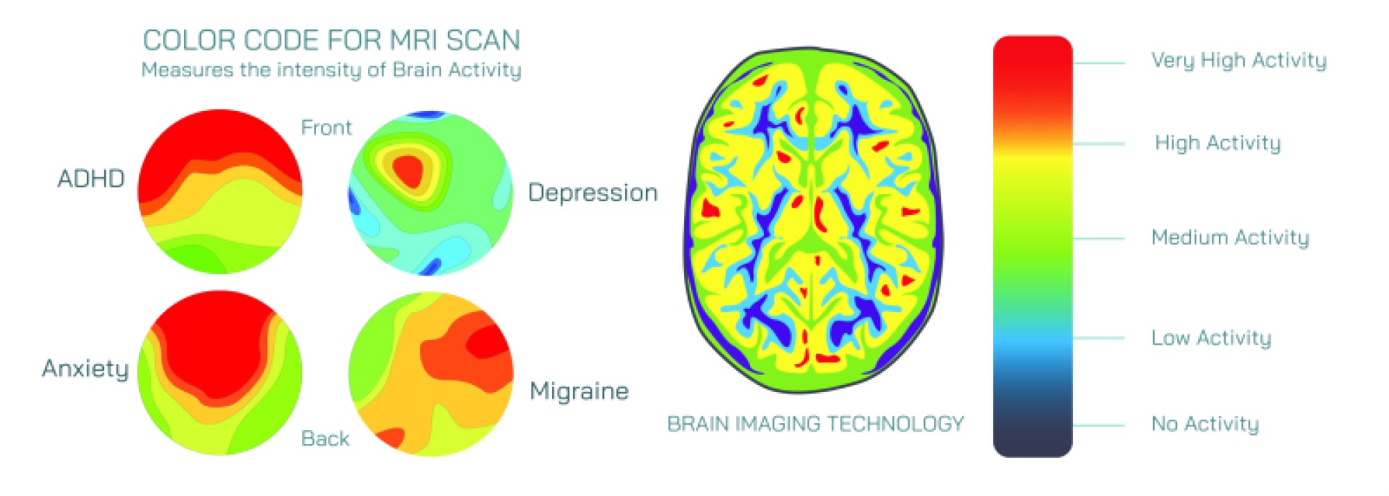 MRI Scan Color Code — Clear Guide to Image Shades, Tissue Patterns, and Contrast Meaning