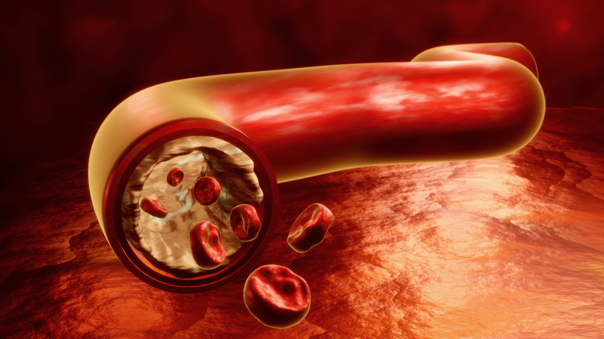3D Rendered Cholesterol Deposits Inside Human Vein and Artery Illustration