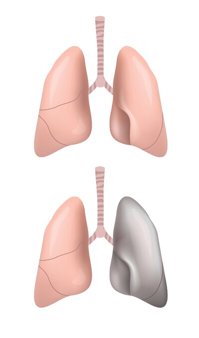 Healthy and Unhealthy Lungs: Differences, Damage Signs, and Respiratory Health Explained