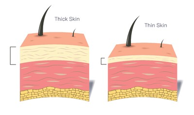 Difference Between Thick and Thin Skin Explained with Structure and Functions